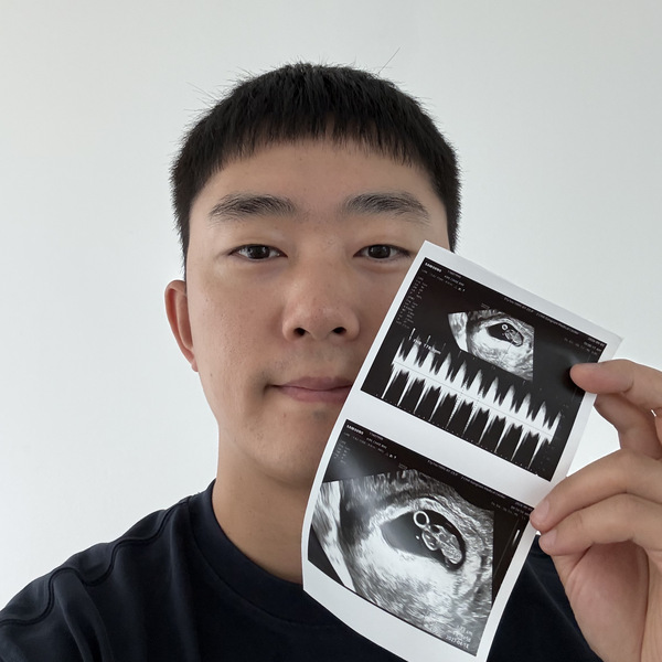Byungjun Kim, Director of WOOAZ Lab, holding an ultrasound printout